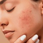 Skin diseases types causes symptoms treatment doctors